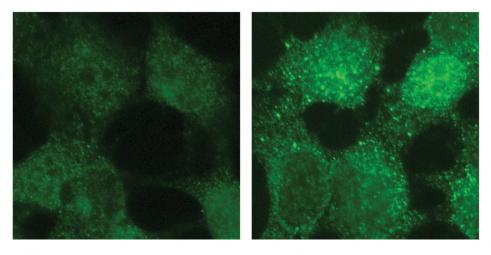 Olga molecular infant cancer